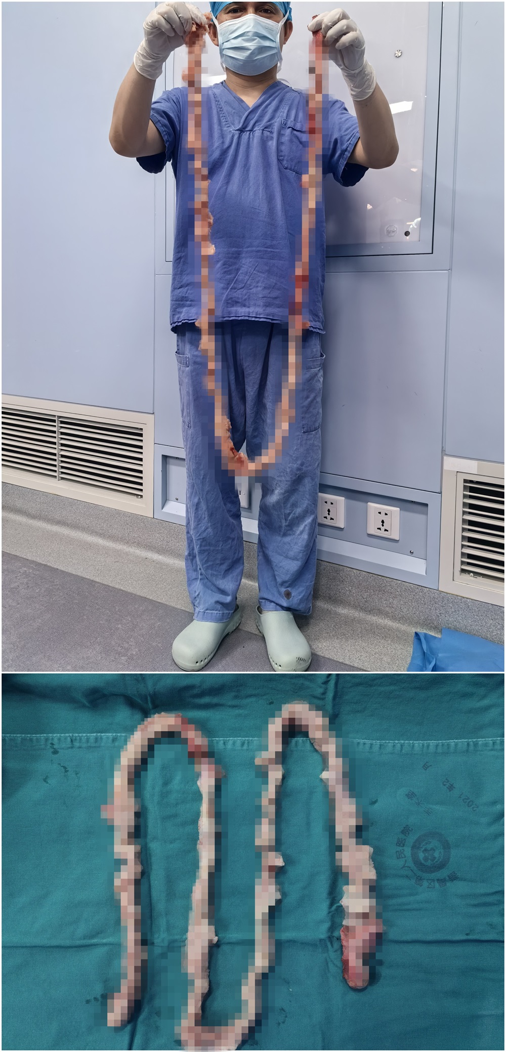 6切除的子宫.jpg