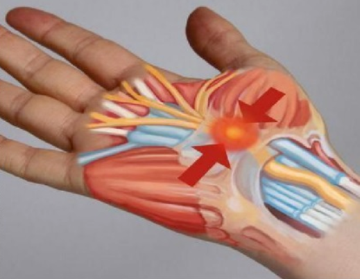 科普 | 肌肉痛？关节痛？肌骨超声大显身手